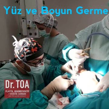 Yüz ve boyun germe