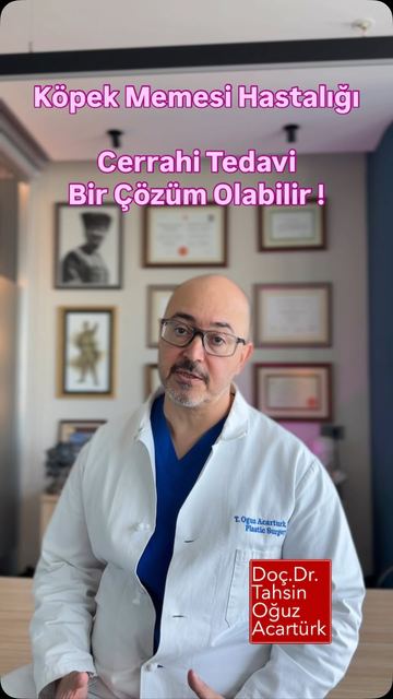 Köpek memesi (hidradenit) cerrahi tedavisi